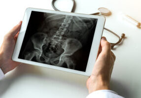 Doctor watching a x-ray of hips and spine for back pain on digital tablet.